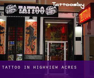 Tattoo in Highview Acres