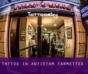 Tattoo in Antietam Farmettes