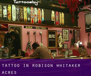 Tattoo in Robison-Whitaker Acres