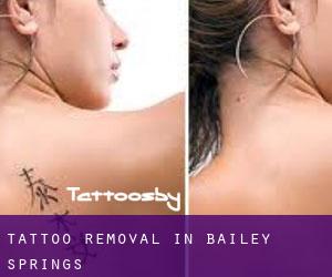 Tattoo Removal in Bailey Springs
