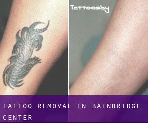 Tattoo Removal in Bainbridge Center