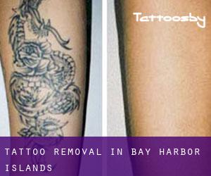 Tattoo Removal in Bay Harbor Islands