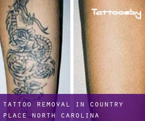 Tattoo Removal in Country Place (North Carolina)