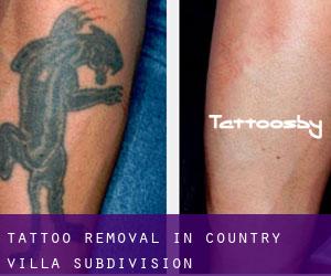 Tattoo Removal in Country Villa Subdivision