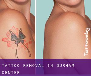 Tattoo Removal in Durham Center