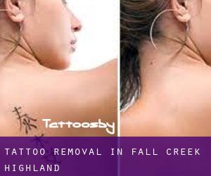 Tattoo Removal in Fall Creek Highland