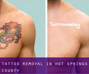 Tattoo Removal in Hot Springs County