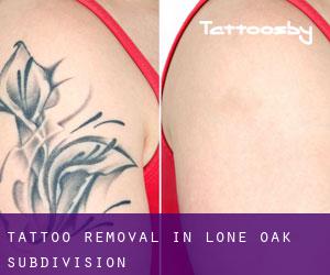 Tattoo Removal in Lone Oak Subdivision