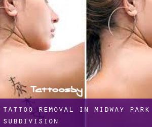 Tattoo Removal in Midway Park Subdivision