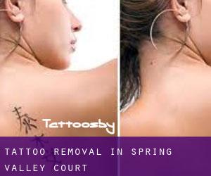 Tattoo Removal in Spring Valley Court